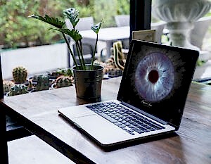 Dijital Göz Fotoğrafları