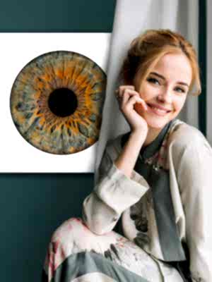 diasec iris göz